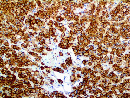 IHC of MDR-1 on an FFPE Adrenal Tissue